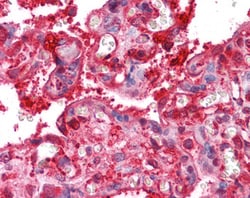 Invitrogen Radixin Polyclonal Antibody 100 &mu;g; Unconjugated:Antibodies,
