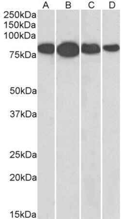 Invitrogen Radixin Polyclonal Antibody 100 &mu;g; Unconjugated:Antibodies,