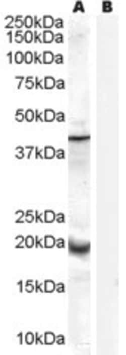 Invitrogen GPX7 Polyclonal Antibody 100 &mu;g; Unconjugated:Antibodies,