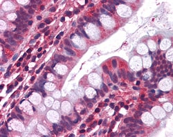 Invitrogen HTR3A Polyclonal Antibody 100 &mu;g; Unconjugated:Antibodies,