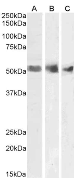 Invitrogen WT1 Polyclonal Antibody 100 &mu;g; Unconjugated:Antibodies,