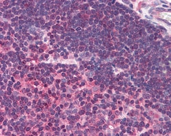 Invitrogen Munc13-4 Polyclonal Antibody 100 &mu;g; Unconjugated:Antibodies,