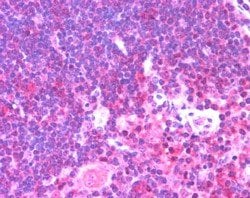 Invitrogen Munc13-4 Polyclonal Antibody 100 &mu;g; Unconjugated:Antibodies,