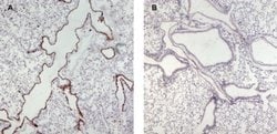 Invitrogen™ Munc13-4 Polyclonal Antibody