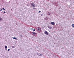Invitrogen GBX2 Polyclonal Antibody 100 &mu;g; Unconjugated:Antibodies,