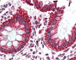 Invitrogen TSPO Polyclonal Antibody 100 &mu;g; Unconjugated:Antibodies,