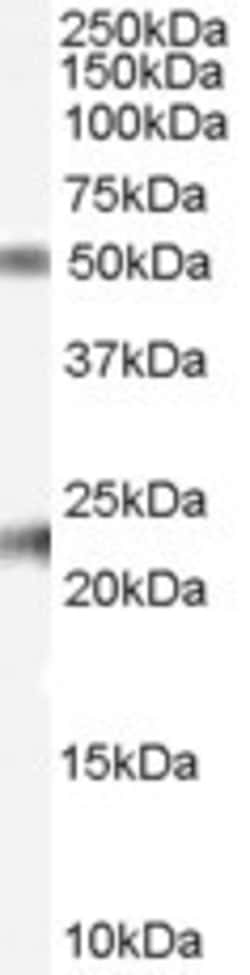 Invitrogen Fibulin 5 Polyclonal Antibody 100 &mu;g; Unconjugated:Antibodies,
