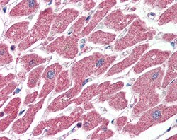 Invitrogen CPT1A Polyclonal Antibody 100 &mu;g | Buy Online | Invitrogen&trade; | Fisher Scientific