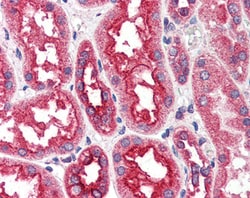 Invitrogen CPT1A Polyclonal Antibody 100 &mu;g | Buy Online | Invitrogen&trade; | Fisher Scientific