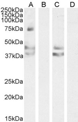 Invitrogen AGTR1 Polyclonal Antibody 100 &mu;g; Unconjugated:Antikroppar