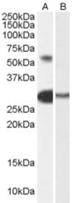 Invitrogen TCFL5 Polyclonal Antibody 100 &mu;g; Unconjugated:Antibodies,