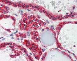 Invitrogen LPIN3 Polyclonal Antibody 100 &mu;g; Unconjugated:Antibodies,