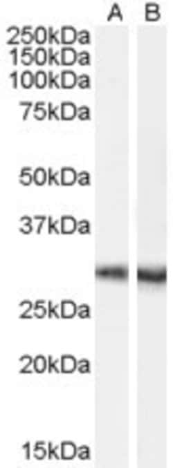 Invitrogen DCDC2 Polyclonal Antibody 100 &mu;g; Unconjugated:Antibodies,