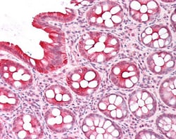 Invitrogen PICK1 Polyclonal Antibody 100 &mu;g | Buy Online | Invitrogen&trade; | Fisher Scientific