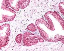 Invitrogen PICK1 Polyclonal Antibody 100 &mu;g | Buy Online | Invitrogen&trade; | Fisher Scientific