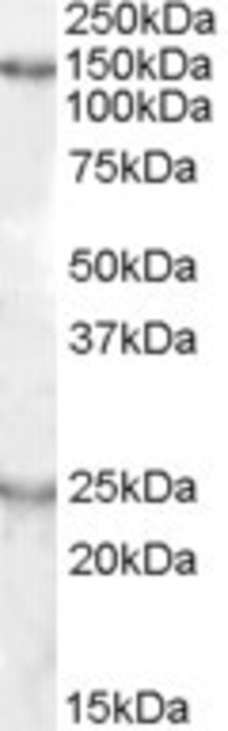 Invitrogen Kiaa0319 Polyclonal Antibody 100 &mu;g; Unconjugated:Antibodies,