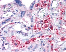 Invitrogen SLC7A11 Polyclonal Antibody 100 &mu;g; Unconjugated:Antibodies,