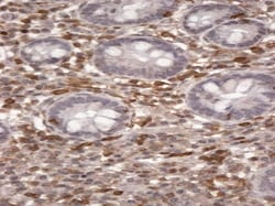 Invitrogen S100A4 Polyclonal Antibody 100 &mu;g; Unconjugated:Antibodies,