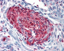 Invitrogen S100A4 Polyclonal Antibody 100 &mu;g; Unconjugated:Antibodies,
