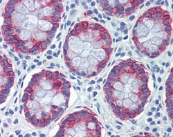 Invitrogen AGR2 Polyclonal Antibody 100 &mu;g; Unconjugated:Antibodies,