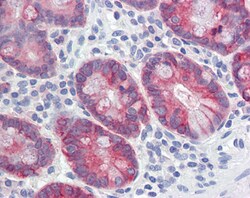 Invitrogen AGR2 Polyclonal Antibody 100 &mu;g; Unconjugated:Antibodies,