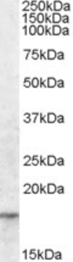 Invitrogen AGR2 Polyclonal Antibody 100 &mu;g; Unconjugated:Antibodies,