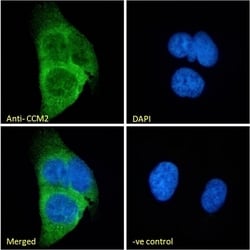 Invitrogen CCM2 Polyclonal Antibody 100 &mu;g; Unconjugated:Antibodies,
