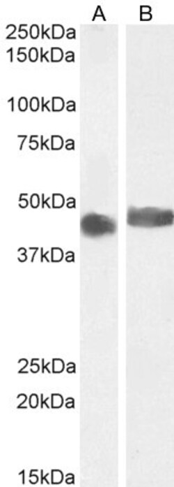 Invitrogen CCM2 Polyclonal Antibody 100 &mu;g; Unconjugated:Antibodies,