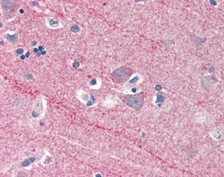 Invitrogen ICAM-5 Precursor Polyclonal Antibody 100 &mu;g; Unconjugated:Antibodies,