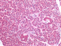 Invitrogen PIK3CA Polyclonal Antibody 100 &mu;g | Buy Online | Invitrogen&trade; | Fisher Scientific