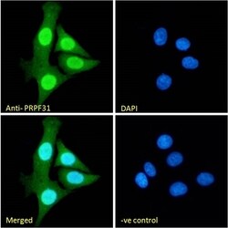 Invitrogen™ PRPF31 Polyclonal Antibody