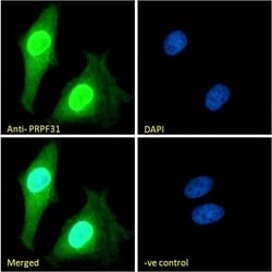 Invitrogen PRPF31 Polyclonal Antibody 100 &mu;g; Unconjugated:Antibodies,