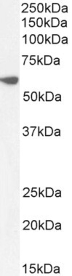 Invitrogen PRPF31 Polyclonal Antibody 100 &mu;g; Unconjugated:Antibodies,