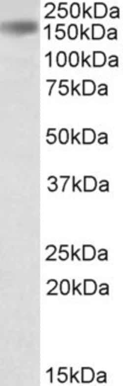 Invitrogen Drosha Polyclonal Antibody 100 &mu;g; Unconjugated:Anticuerpos