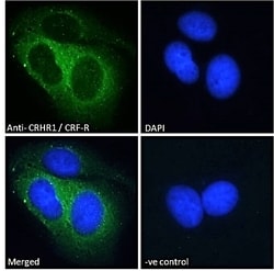 Invitrogen CRHR1 Polyclonal Antibody 100 &mu;g; Unconjugated:Antibodies,