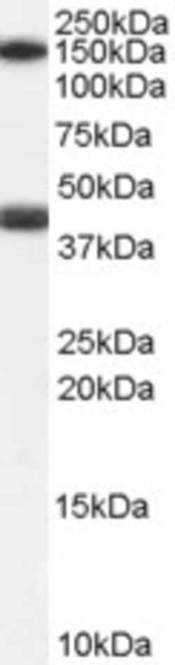 Invitrogen GALR1 Polyclonal Antibody 100 &mu;g | Buy Online | Invitrogen&trade; | Fisher Scientific