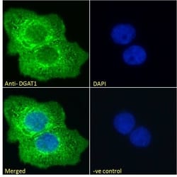 Invitrogen DGAT1 Polyclonal Antibody 100 &mu;g; Unconjugated:Antibodies,