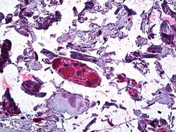 Invitrogen DGAT1 Polyclonal Antibody 100 &mu;g; Unconjugated:Antibodies,