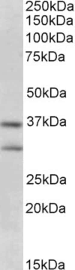 Invitrogen FGF23 Polyclonal Antibody 100 &mu;g; Unconjugated:Antibodies,
