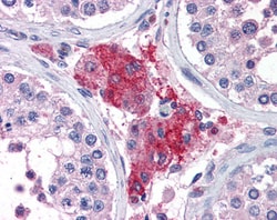 Invitrogen ACYP1 Polyclonal Antibody 100 &mu;g; Unconjugated:Antibodies,