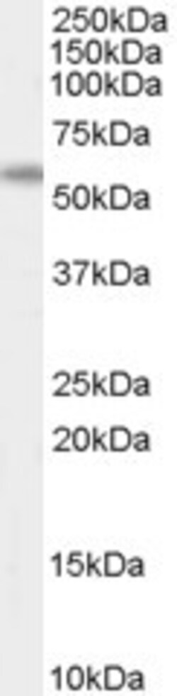 Invitrogen AIRE Polyclonal Antibody 100 &mu;g | Buy Online | Invitrogen&trade; | Fisher Scientific