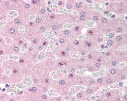 Invitrogen C14orf68 Polyclonal Antibody 100 &mu;g | Buy Online | Invitrogen&trade; | Fisher Scientific