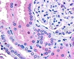 Invitrogen RNF213 Polyclonal Antibody 100 &mu;g; Unconjugated:Antibodies,