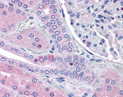 Invitrogen RNF213 Polyclonal Antibody 100 &mu;g; Unconjugated:Antibodies,