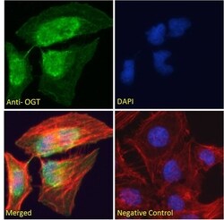 Invitrogen OGT Polyclonal Antibody 100 &mu;g; Unconjugated:Antibodies,