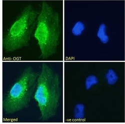 Invitrogen OGT Polyclonal Antibody 100 &mu;g; Unconjugated:Antibodies,