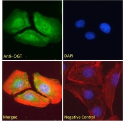 Invitrogen OGT Polyclonal Antibody 100 &mu;g; Unconjugated:Antibodies,