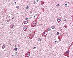Invitrogen OGT Polyclonal Antibody 100 &mu;g; Unconjugated:Antibodies,