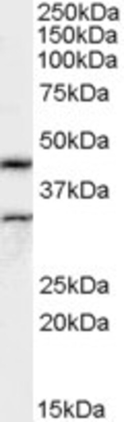 Invitrogen Actin-like 7B Polyclonal Antibody 100 &mu;g; Unconjugated:Antibodies,