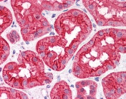 Invitrogen CGI58 Polyclonal Antibody 100 &mu;g; Unconjugated:Antibodies,